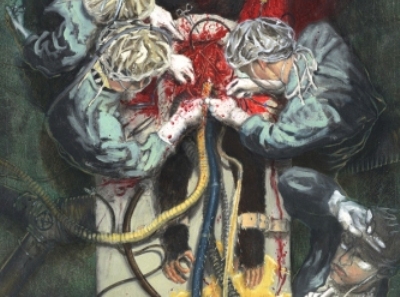Simian Operation